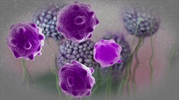 Digital 3d illustration of cancer cells in human body